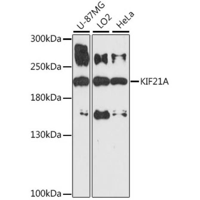 KIF21A Rabbit Polyclonal Antibody
