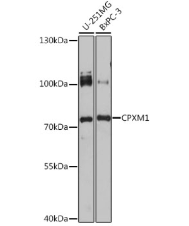 CPXM1 Rabbit Polyclonal Antibody