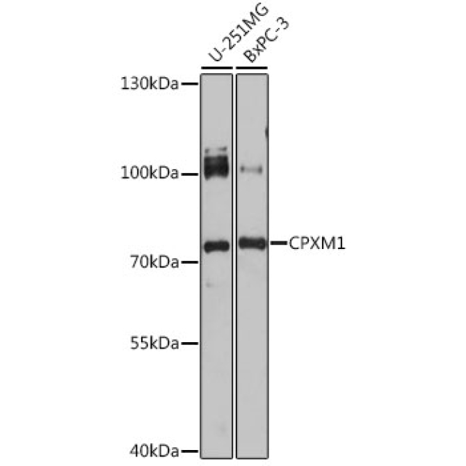 CPXM1 Rabbit Polyclonal Antibody