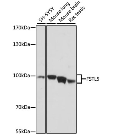FSTL5 Rabbit Polyclonal Antibody
