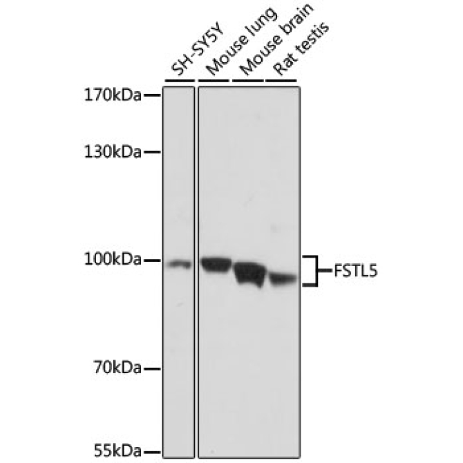 FSTL5 Rabbit Polyclonal Antibody