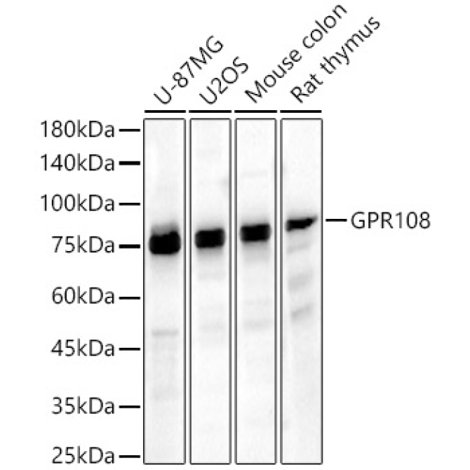 GPR19,400 Rabbit Polyclonal Antibody