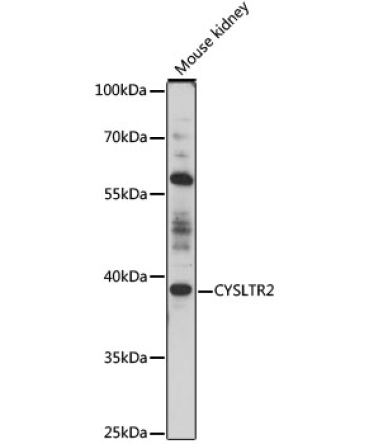 CYSLTR2 Rabbit Polyclonal Antibody