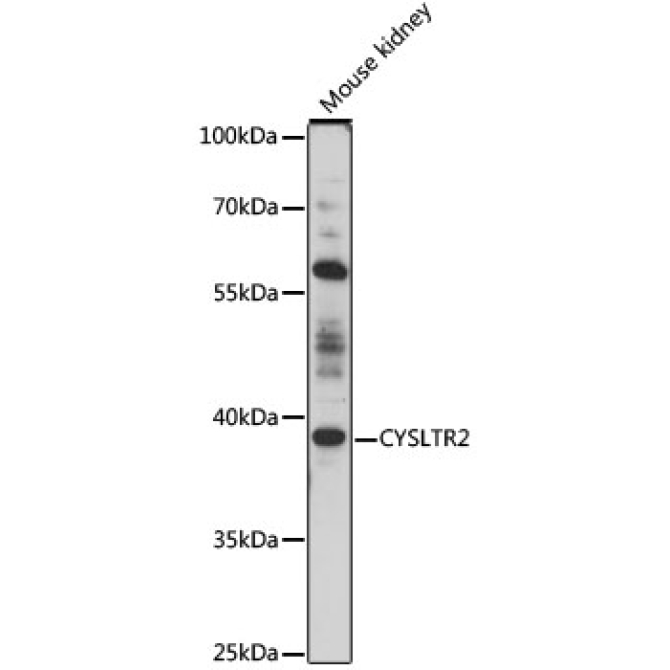 CYSLTR2 Rabbit Polyclonal Antibody