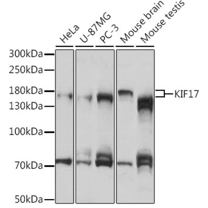 KIF17 Rabbit Polyclonal Antibody