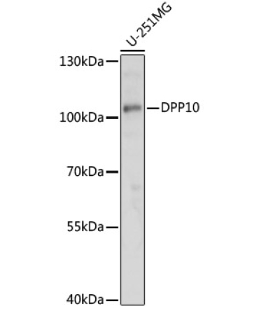 DPP10 Rabbit Polyclonal Antibody