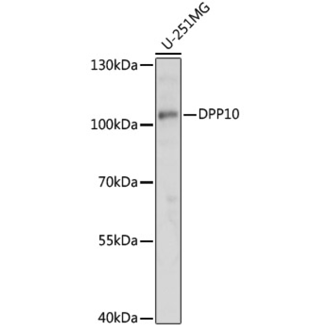 DPP10 Rabbit Polyclonal Antibody