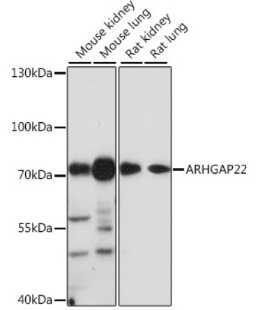 ARHGAP22 Rabbit Polyclonal Antibody