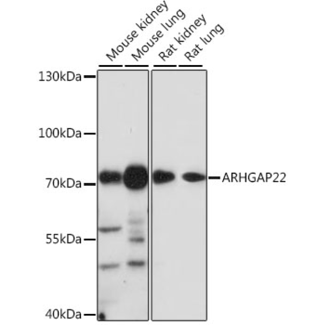 ARHGAP22 Rabbit Polyclonal Antibody