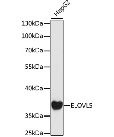 ELOVL5 Rabbit Polyclonal Antibody