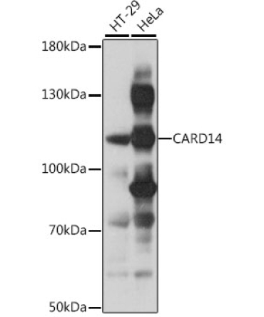 CARD14 Rabbit Polyclonal Antibody