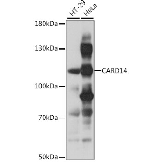 CARD14 Rabbit Polyclonal Antibody