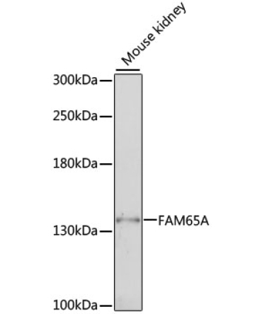 FAM65A Rabbit Polyclonal Antibody