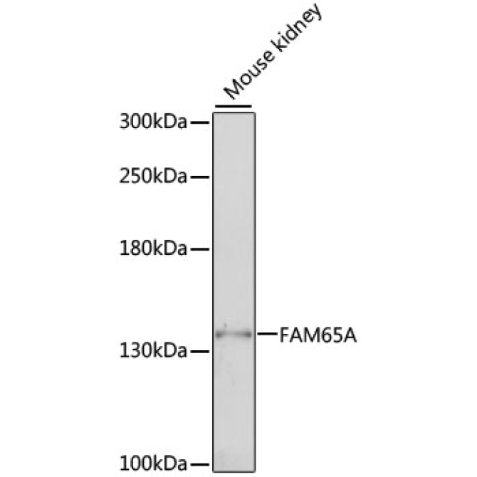 FAM65A Rabbit Polyclonal Antibody