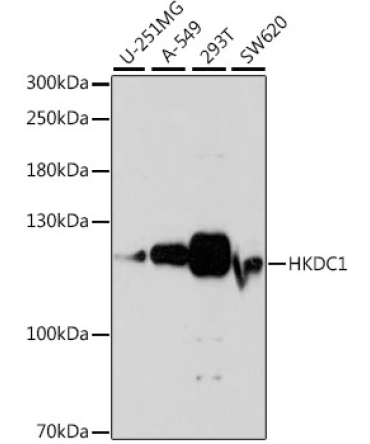 HKDC1 Rabbit Polyclonal Antibody