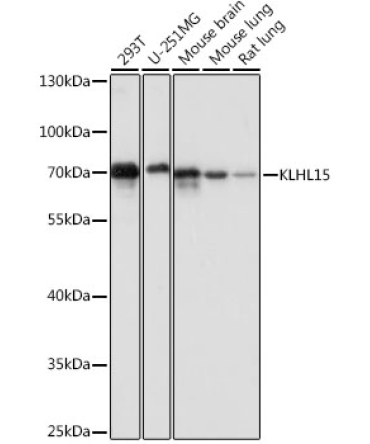 KLHL15 Rabbit Polyclonal Antibody