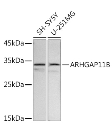 ARHGAP11B Rabbit Polyclonal Antibody