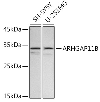 ARHGAP11B Rabbit Polyclonal Antibody