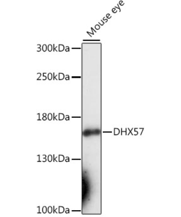DHX57 Rabbit Polyclonal Antibody