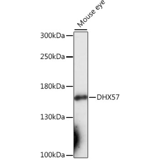 DHX57 Rabbit Polyclonal Antibody