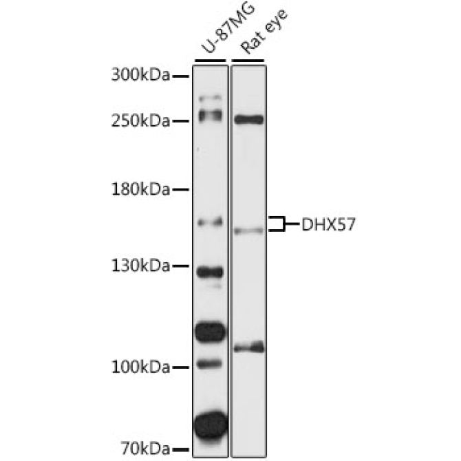 DHX57 Rabbit Polyclonal Antibody
