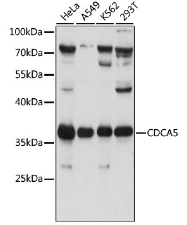 CDCA5 Rabbit Polyclonal Antibody