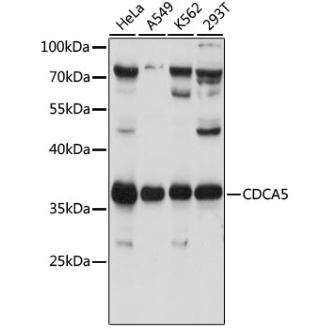 CDCA5 Rabbit Polyclonal Antibody