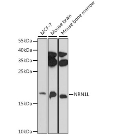 NRN1L Rabbit Polyclonal Antibody
