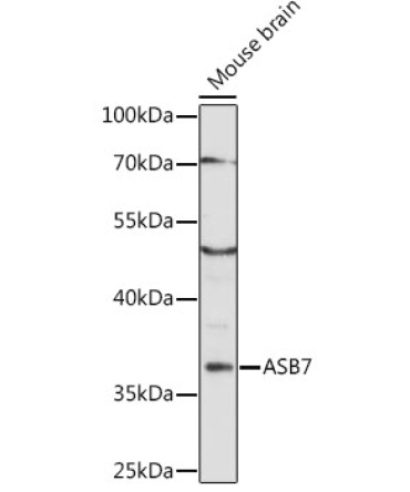 ASB7 Rabbit Polyclonal Antibody