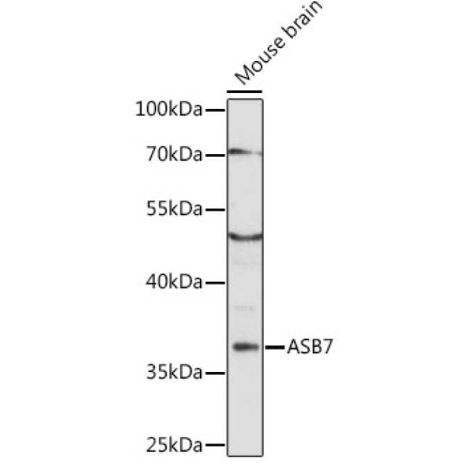 ASB7 Rabbit Polyclonal Antibody