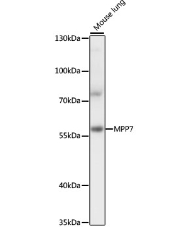 MPP7 Rabbit Polyclonal Antibody