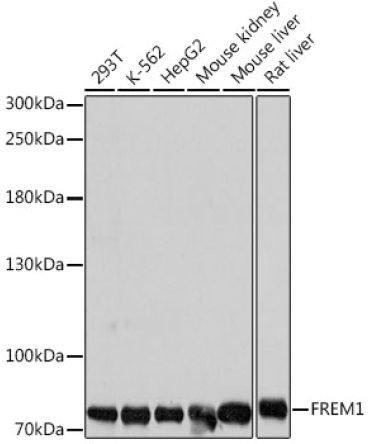 FREM1 Rabbit Polyclonal Antibody