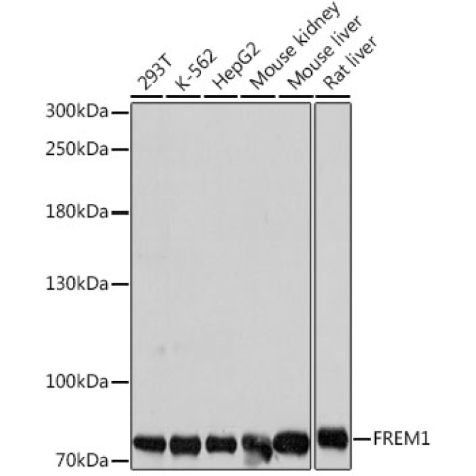 FREM1 Rabbit Polyclonal Antibody