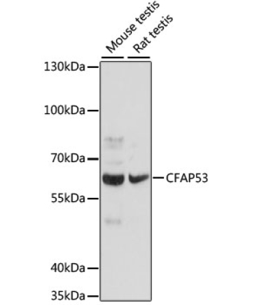 CFAP53 Rabbit Polyclonal Antibody