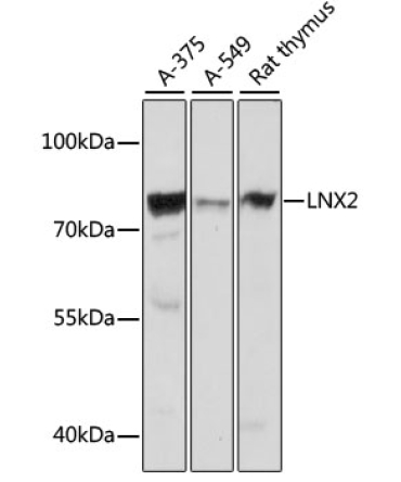 LNX2 Rabbit Polyclonal Antibody