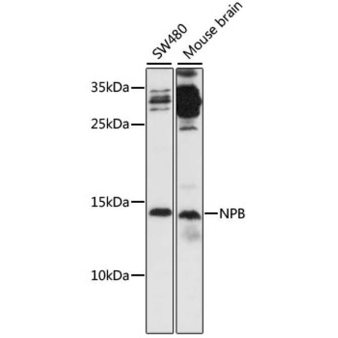 NPB Rabbit Polyclonal Antibody