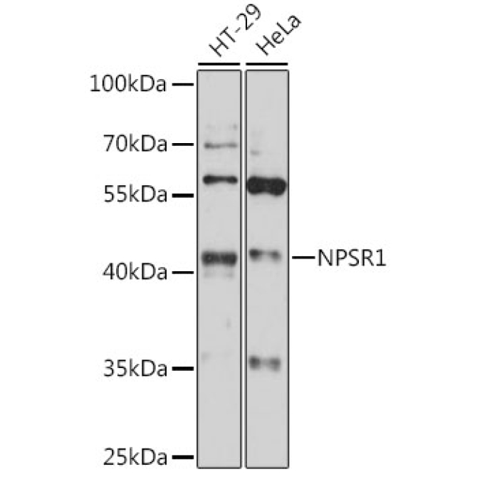 NPSR1 Rabbit Polyclonal Antibody