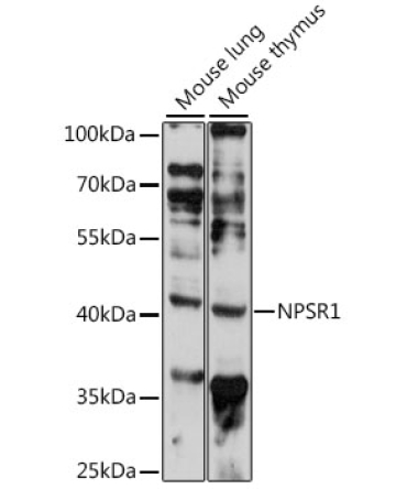 NPSR1 Rabbit Polyclonal Antibody