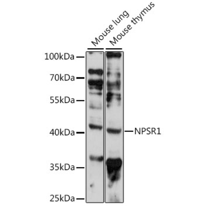NPSR1 Rabbit Polyclonal Antibody