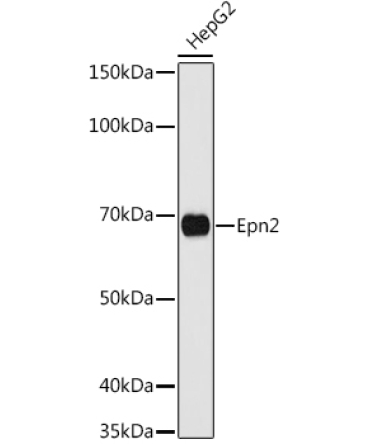 Epn2 Rabbit Polyclonal Antibody