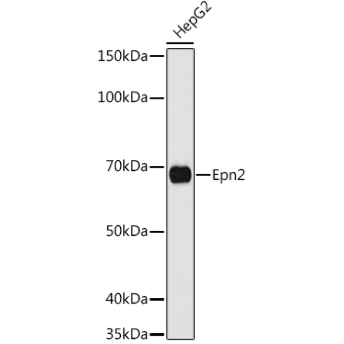Epn2 Rabbit Polyclonal Antibody