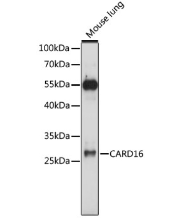 CARD16 Rabbit Polyclonal Antibody