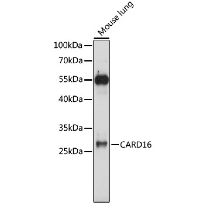 CARD16 Rabbit Polyclonal Antibody
