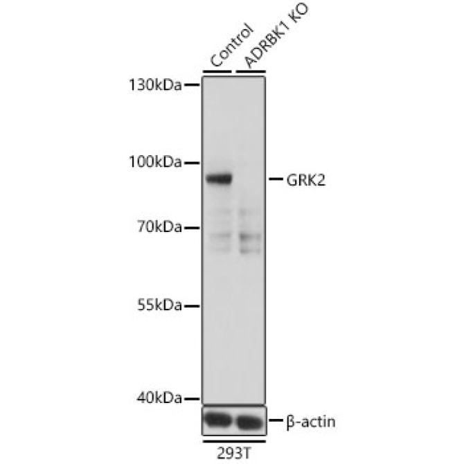 GRK2 Rabbit Polyclonal Antibody [KO Validated]