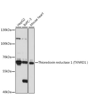 Human Thioredoxin Reductase 1/TRXR1 Rabbit Polyclonal Antibody