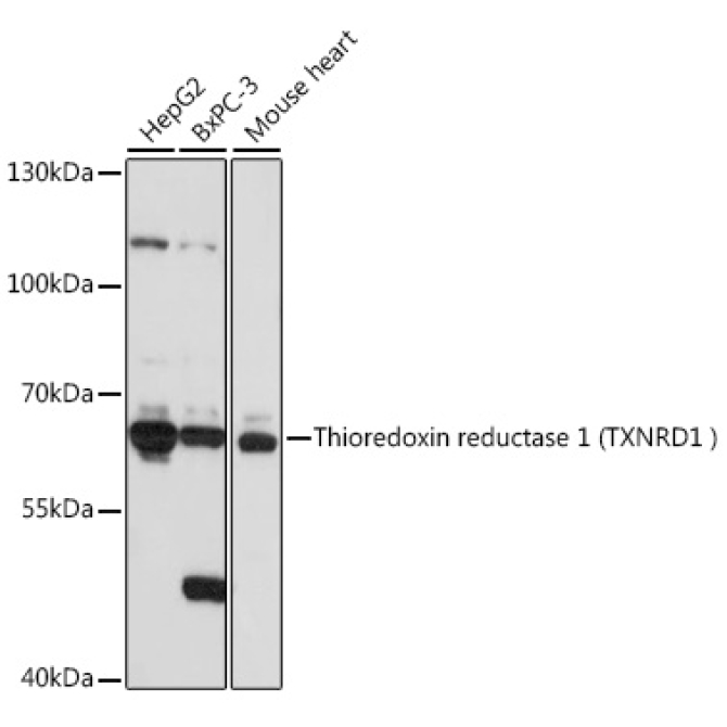 Human Thioredoxin Reductase 1/TRXR1 Rabbit Polyclonal Antibody
