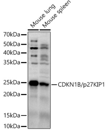 CDKN1B/p27KIP1 Rabbit Polyclonal Antibody
