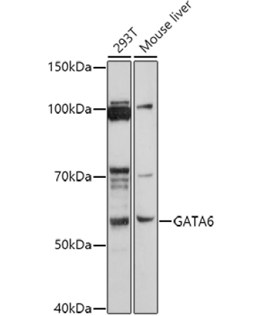 GATA6 Rabbit Polyclonal Antibody