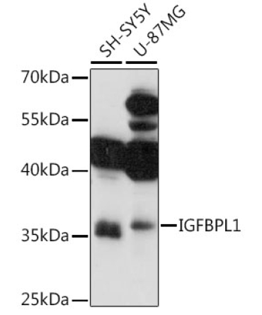 IGFBPL1 Rabbit Polyclonal Antibody