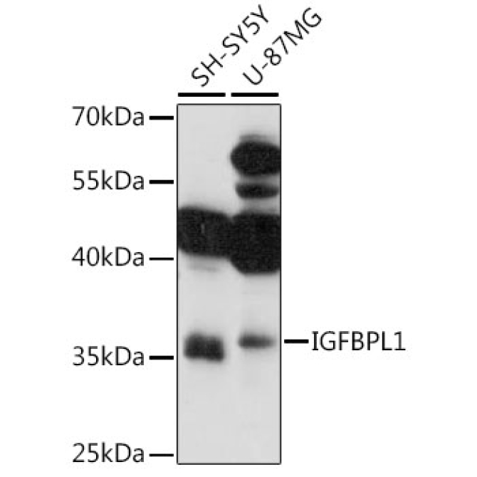 IGFBPL1 Rabbit Polyclonal Antibody